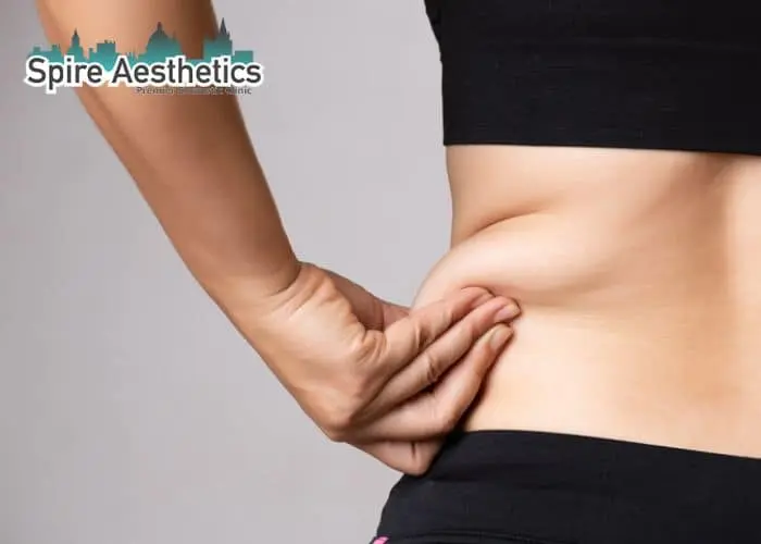Image of woman pinching fat on their hips Uppingham. Fat Freezing treatment